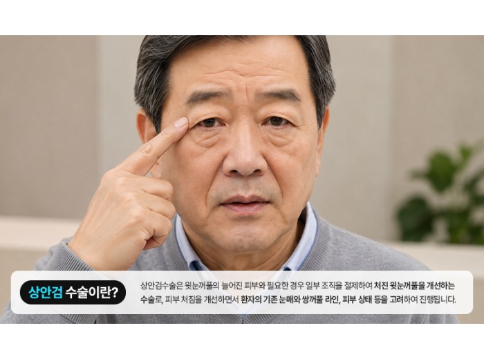 상안검 수술 회복기간은? 흉터와 수술 방법 알아보기