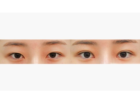 자연유착